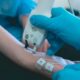 Un estudio científico reveló que el coronavirus deja secuelas neurológicas en los más jóvenes.