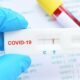 El test de detección de Covid 19 de libre venta en farmacias no tiene demanda.