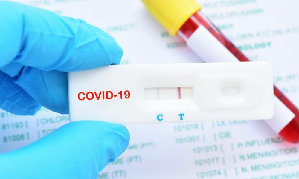 El test de detección de Covid 19 de libre venta en farmacias no tiene demanda. El test de detección de Covid 19 de libre venta en farmacias no tiene demanda.