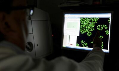 Investigadores desarrollan una técnica no invasiva para detectar el cáncer.