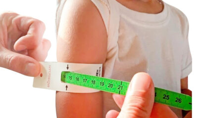 Se distribuye en Argentina una cinta que permite medir malnutrición en niños.