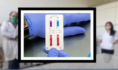 Una empresa argentina desarrolló un test rápido para Covid-19 con resultados en 10 minutos.