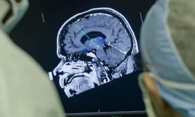 Científicos desarrollan un implante cerebral para eliminar pensamientos negativos y prevenir la depresión.