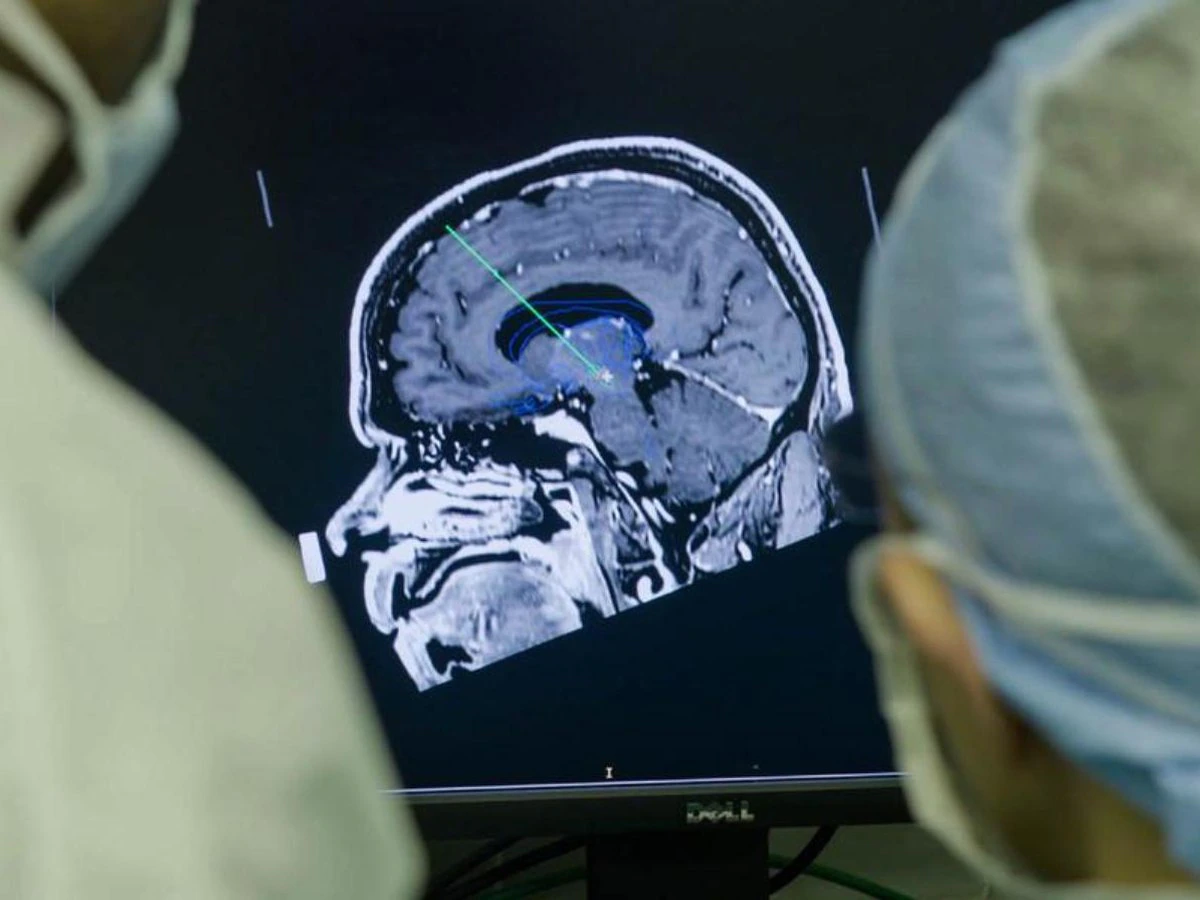 Científicos desarrollan un implante cerebral para eliminar pensamientos negativos y prevenir la depresión. Científicos desarrollan un implante cerebral para eliminar pensamientos negativos y prevenir la depresión.