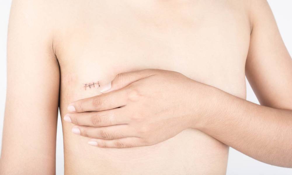 Lucha contra el Cancer de Mama: desde Salud realizan actividades de concientización y prevensión. Lucha contra el Cancer de Mama: desde Salud realizan actividades de concientización y prevensión.