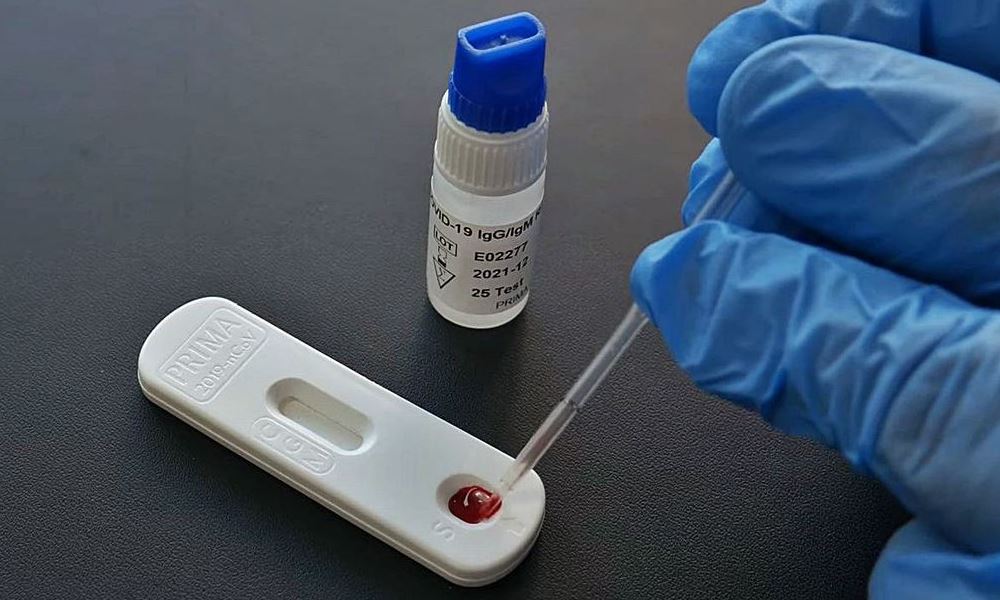 Covid-19: los autotest estarán a la venta en farmacias en enero. Covid-19: los autotest estarán a la venta en farmacias en enero.