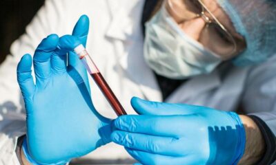 Investigadores avanzan en la comprensión del fenómeno de inmunidad al VIH.