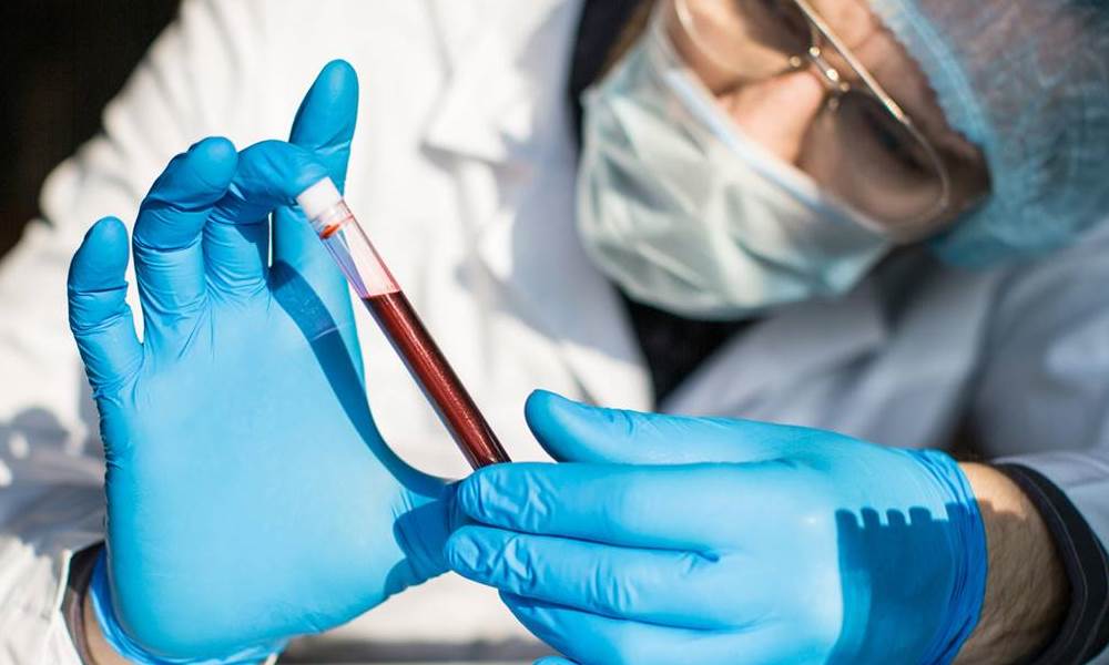 Investigadores avanzan en la comprensión del fenómeno de inmunidad al VIH. Investigadores avanzan en la comprensión del fenómeno de inmunidad al VIH.