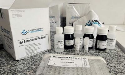 Científicas del Conicet desarrollaron un kit para detectar anticuerpos de SARS-CoV-2.