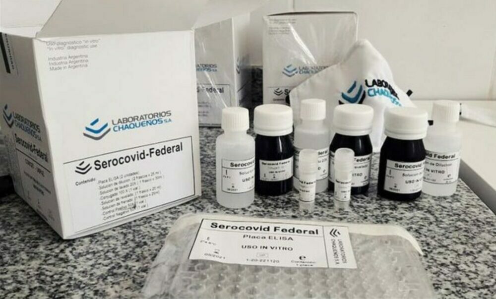Científicas del Conicet desarrollaron un kit para detectar anticuerpos de SARS-CoV-2. Científicas del Conicet desarrollaron un kit para detectar anticuerpos de SARS-CoV-2.