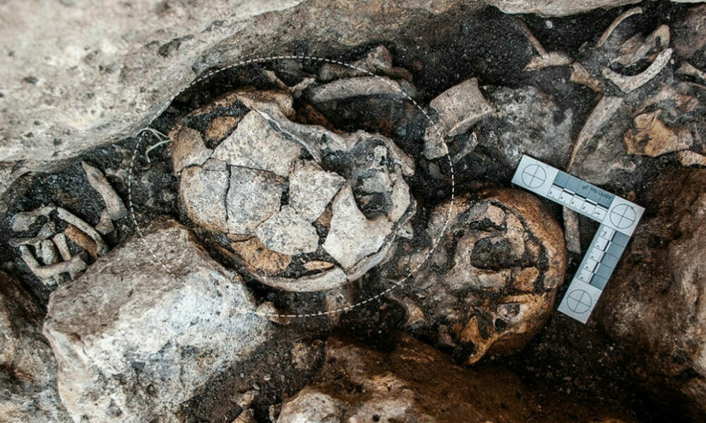 Descubren un cráneo femenino de hace 5.300 años con los primeros indicios conocidos de una cirugía de oído. Descubren un cráneo femenino de hace 5.300 años con los primeros indicios conocidos de una cirugía de oído.