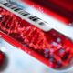  Día Mundial de la Hemofilia: ¿Qué es y por qué sucede?