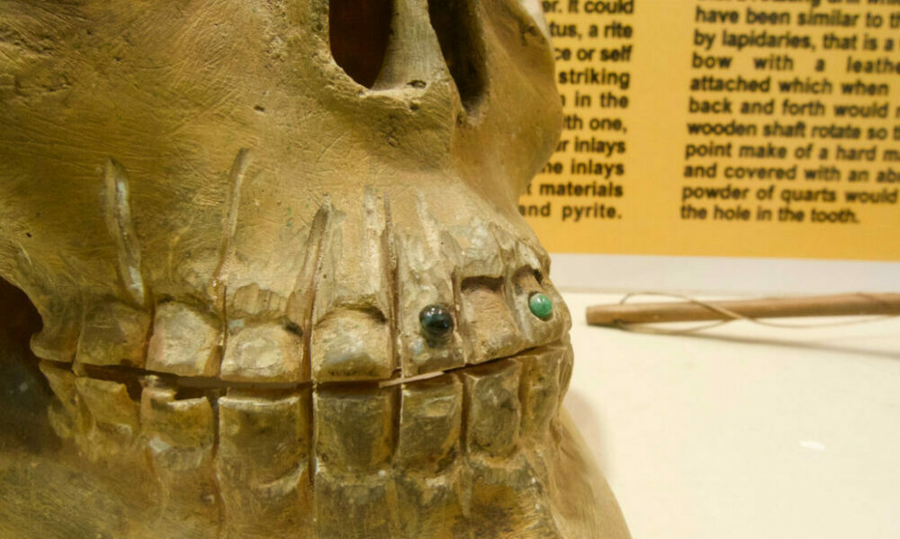 Estudio revela por qué los mayas se incrustaban piedras preciosas en los dientes. Estudio revela por qué los mayas se incrustaban piedras preciosas en los dientes.