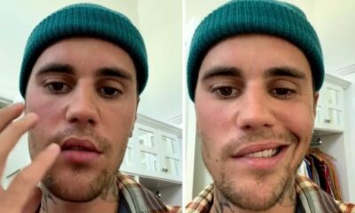 Justin Bieber cancela sus conciertos tras revelar que padece una parálisis facial parcial.
