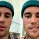 Justin Bieber cancela sus conciertos tras revelar que padece una parálisis facial parcial.