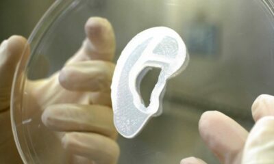 Trasplantan por primera vez una oreja impresa en 3D con células humanas.
