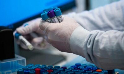 Argentina detectó los dos primeros casos de Candida auris.