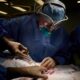 Argentina, puede ser el primer país de la región en transplantar órganos animales a humanos.
