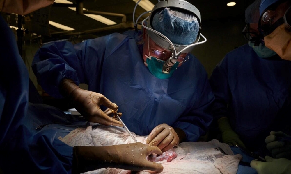 Argentina, puede ser el primer país de la región en transplantar órganos animales a humanos. Argentina, puede ser el primer país de la región en transplantar órganos animales a humanos.