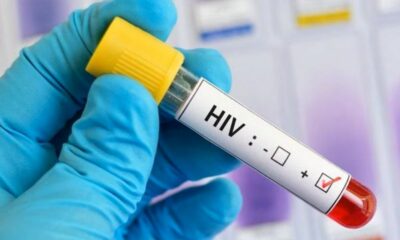 Estudio científico confirmó tercer caso de curación de VIH tras un trasplante de células madres.