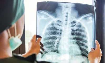 Inteligencia artificial aprende a identificar con precisión el cáncer.