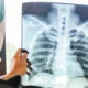 Inteligencia artificial aprende a identificar con precisión el cáncer.