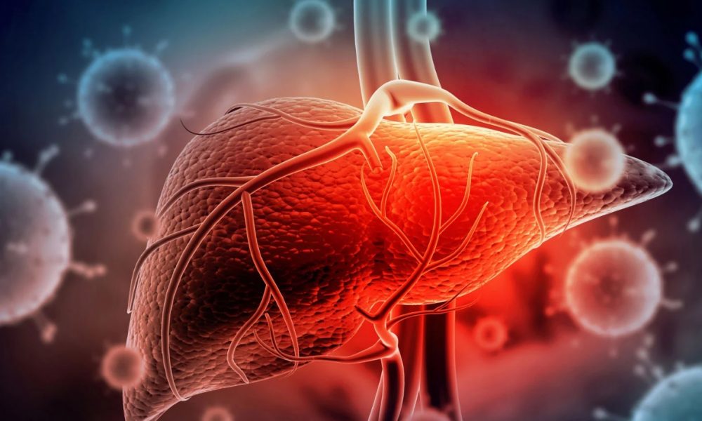 Día Mundial de la Hepatitis: tipos, avances en su prevención y tratamiento. Día Mundial de la Hepatitis: tipos, avances en su prevención y tratamiento.