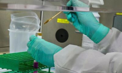 Cruzivax: La vacuna contra el Chagas desarrollada por científicos argentinos.