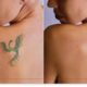 Tranqui, podés arrepentirte de ese tatuaje y removerlo de esta manera.