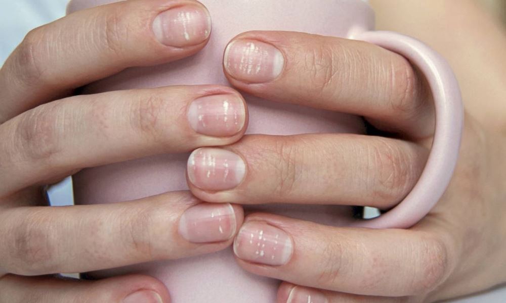 Tus uñas pueden detectar si estás enfermo/a. Tus uñas pueden detectar si estás enfermo/a.