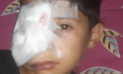 Una madre pide ayuda para costear estudios médicos de su hijo tras una brutal agresión