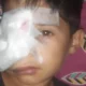 Una madre pide ayuda para costear estudios médicos de su hijo tras una brutal agresión